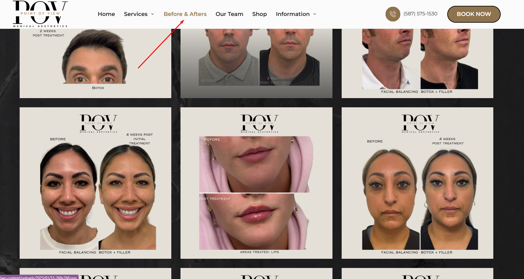 Consider Before-and-After Results and Natural Aesthetic Philosophy